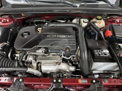 2017 Chevrolet Malibu LT